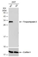 TPM3 Antibody in Western Blot (WB)