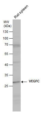 VEGFC Antibody in Western Blot (WB)