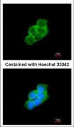 14-3-3 epsilon Polyclonal Antibody