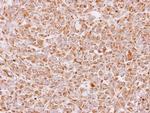 14-3-3 epsilon Antibody in Immunohistochemistry (Paraffin) (IHC (P))