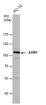 AXIN1 Antibody in Western Blot (WB)