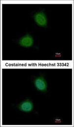 Pirin Polyclonal Antibody