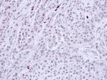 Bub3 Antibody in Immunohistochemistry (Paraffin) (IHC (P))