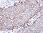 CHRNA4 Polyclonal Antibody