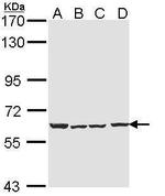CHRNA4 Antibody in Western Blot (WB)