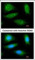 CYLD Antibody in Immunocytochemistry (ICC/IF)