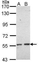 CYP17A1 Polyclonal Antibody