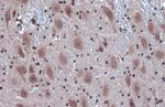 IRE1 alpha Polyclonal Antibody