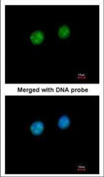 Fibrillarin Polyclonal Antibody