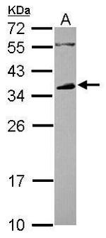 FCGR2B Polyclonal Antibody