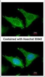 FIBB Polyclonal Antibody