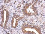 VEGFD Polyclonal Antibody