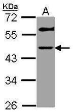 GALT Polyclonal Antibody