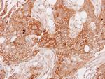GSTA1 Antibody in Immunohistochemistry (Paraffin) (IHC (P))