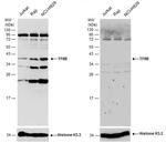 GTF2B Polyclonal Antibody