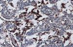 HLA-DRA Antibody in Immunohistochemistry (Paraffin) (IHC (P))