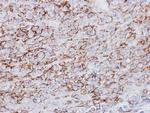 HLA-DRA Antibody in Immunohistochemistry (Paraffin) (IHC (P))