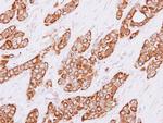 Cytokeratin 4 Polyclonal Antibody