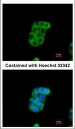 Monoamine Oxidase B Antibody in Immunocytochemistry (ICC/IF)