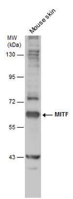 MiTF Antibody in Western Blot (WB)
