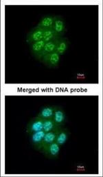 MLK1 Polyclonal Antibody