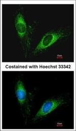 SERPINA5 Polyclonal Antibody