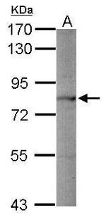 PCSK1 Antibody in Western Blot (WB)