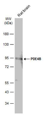 PDE4B Polyclonal Antibody