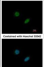 POLD1 Antibody in Immunocytochemistry (ICC/IF)