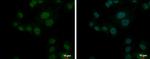 PSMD10 Polyclonal Antibody
