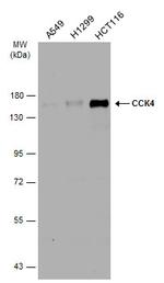 PTK7 Antibody in Western Blot (WB)
