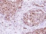 RAD23B Antibody in Immunohistochemistry (Paraffin) (IHC (P))