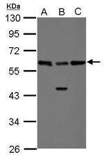 RAD23B Antibody in Western Blot (WB)