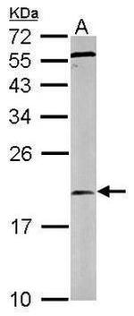 RGS13 Antibody in Western Blot (WB)