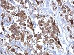 SDHB Antibody in Immunohistochemistry (Paraffin) (IHC (P))