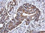 SDHB Antibody in Immunohistochemistry (Paraffin) (IHC (P))