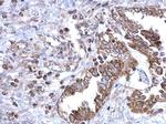 SDHB Antibody in Immunohistochemistry (Paraffin) (IHC (P))