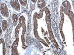 SDHB Antibody in Immunohistochemistry (Paraffin) (IHC (P))
