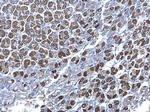 SDHB Antibody in Immunohistochemistry (Paraffin) (IHC (P))