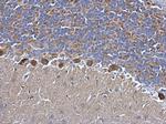 SDHB Antibody in Immunohistochemistry (Paraffin) (IHC (P))
