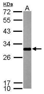 SDHB Antibody in Western Blot (WB)