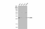 SDHB Antibody in Western Blot (WB)