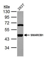 SMARCB1 Antibody in Western Blot (WB)
