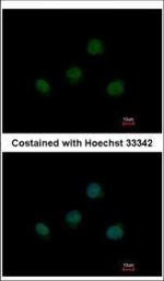 TBX5 Polyclonal Antibody