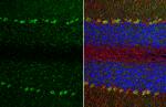 TRPC6 Polyclonal Antibody