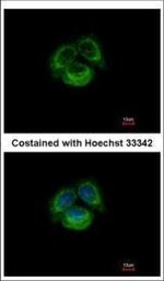 TRPC6 Polyclonal Antibody