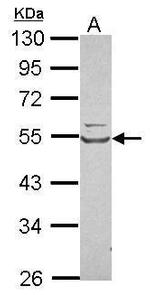 WARS Antibody in Western Blot (WB)