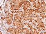 FXR1 Antibody in Immunohistochemistry (Paraffin) (IHC (P))