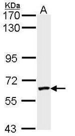 FXR1 Antibody in Western Blot (WB)