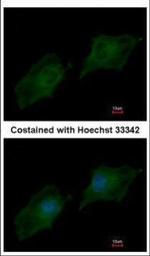 SRC3 Polyclonal Antibody